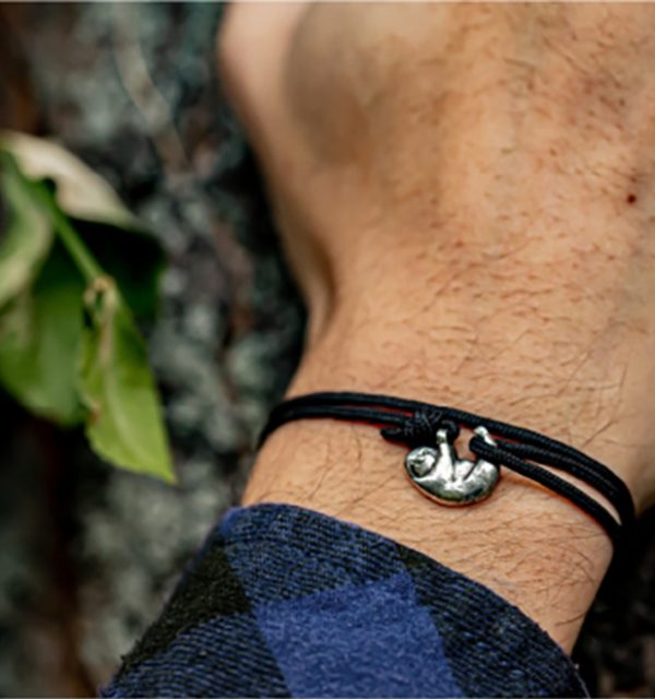 bracelet on arm